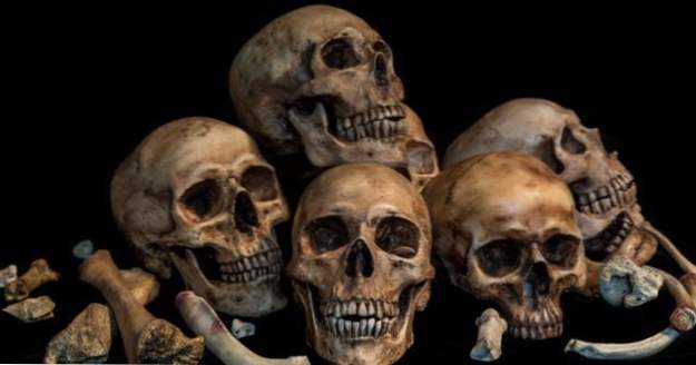 10 historische Fakten zum Skeletthandel (Gruselig)