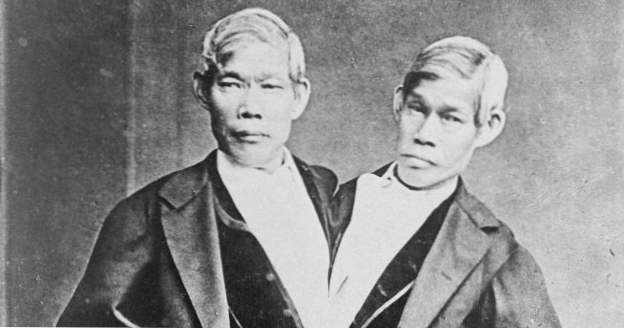 Top 10 des faits étonnants sur les jumeaux siamois originaux