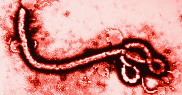 10 důvodů Ebola krize není konec světa