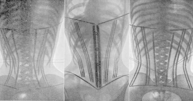 10 bilder som vaggar den medicinska världen (Hälsa)